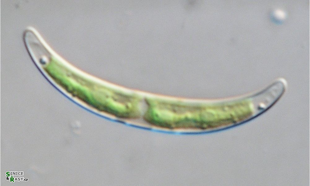 Closterium pseudopygmaeum