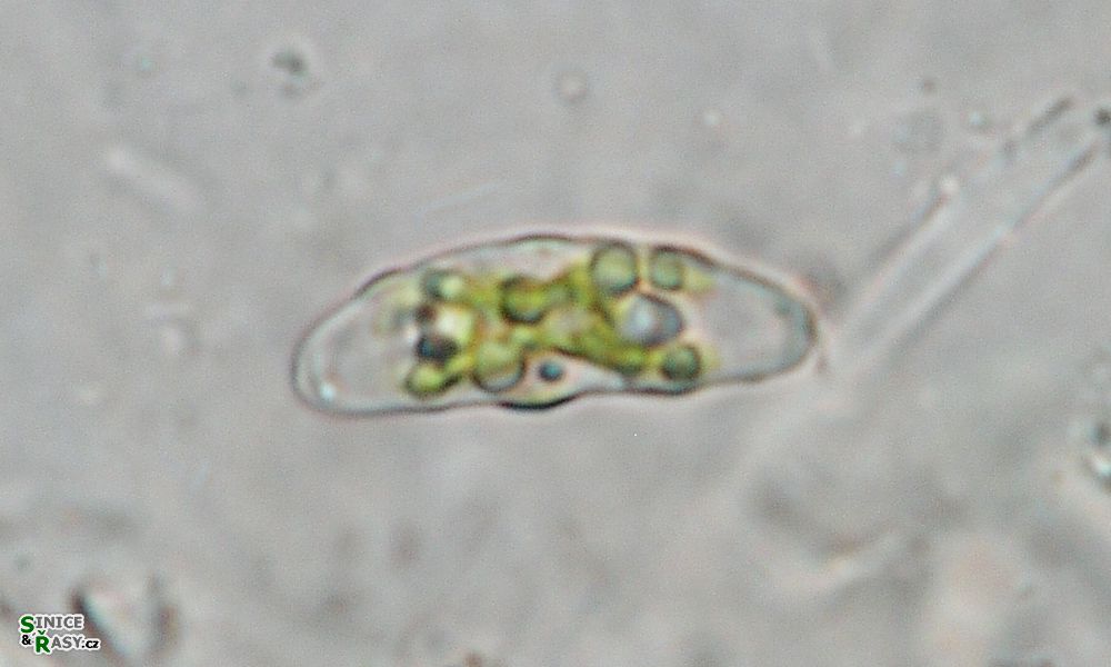 Closterium