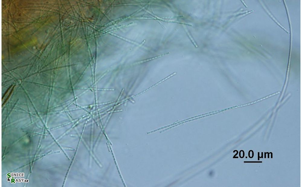 Pseudanabaena frigida