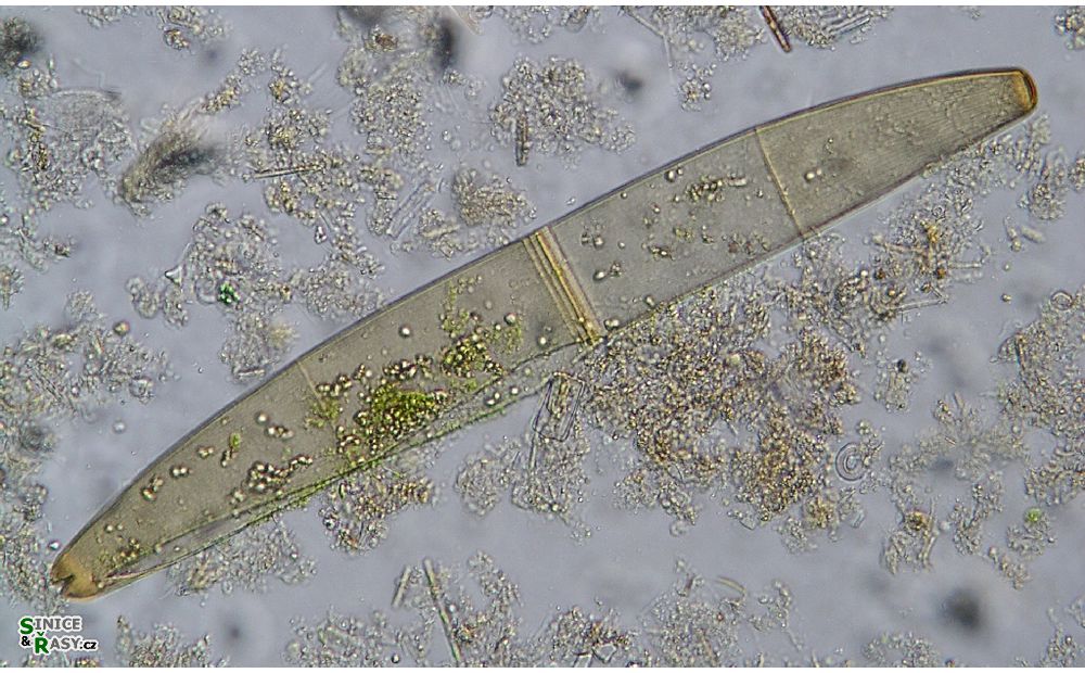 Closterium didymotocum