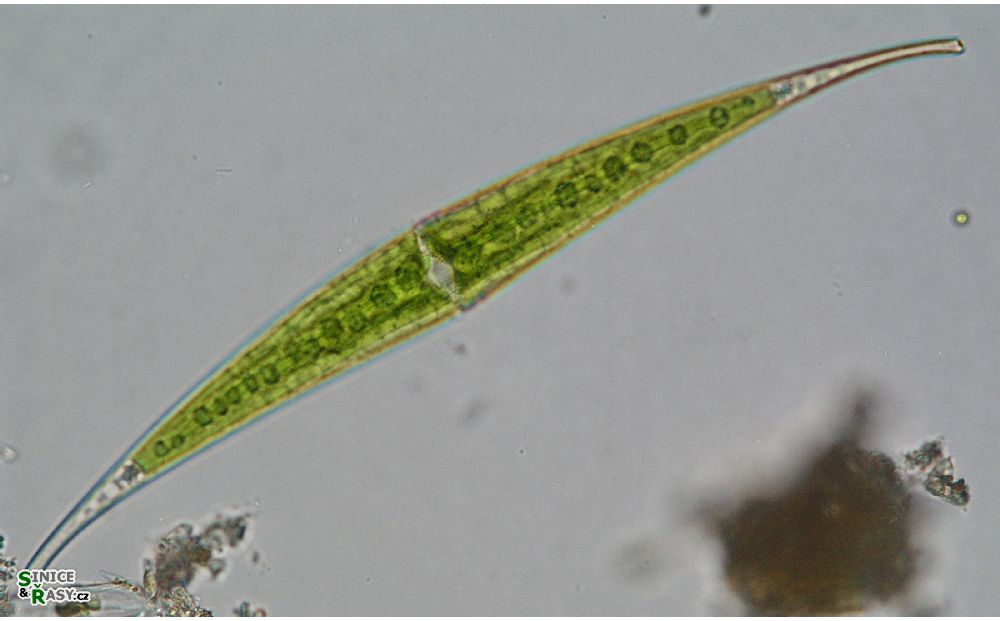 Closterium rostratum