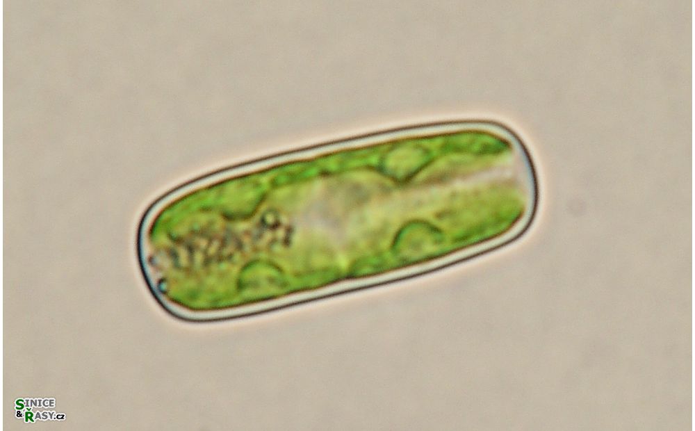 Cylindrocystis