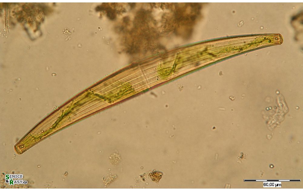 Closterium costatum