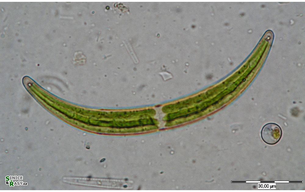 Closterium cynthia