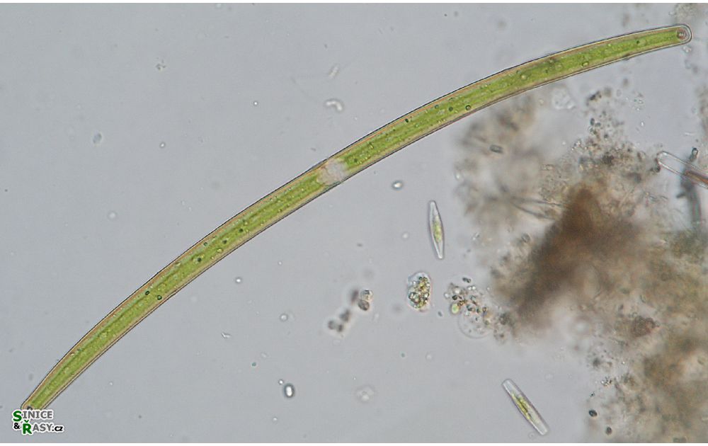Closterium juncidum