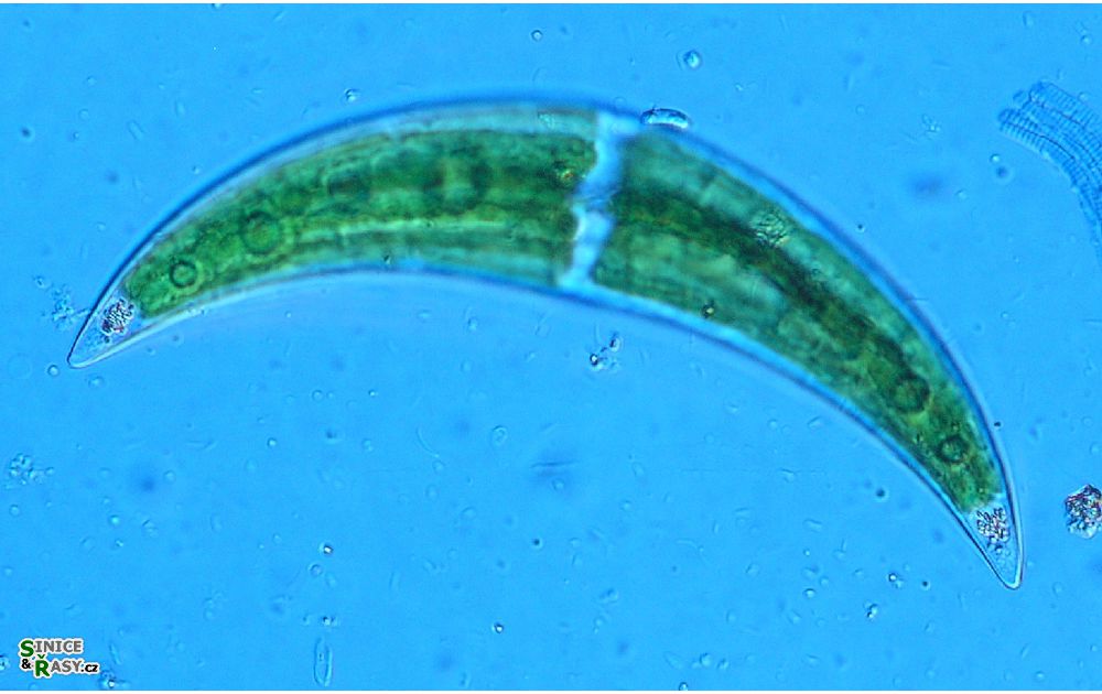 Closterium leibleinii