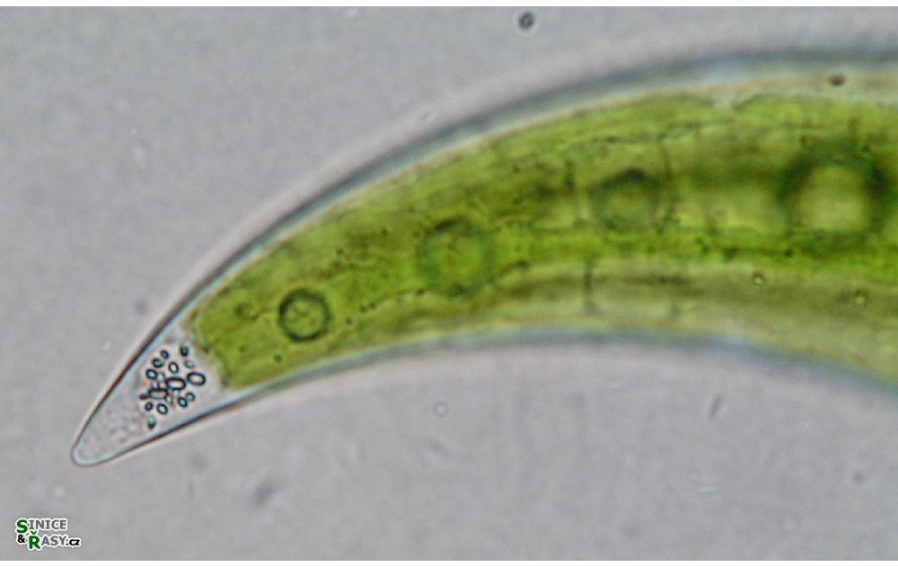 Closterium leibleinii