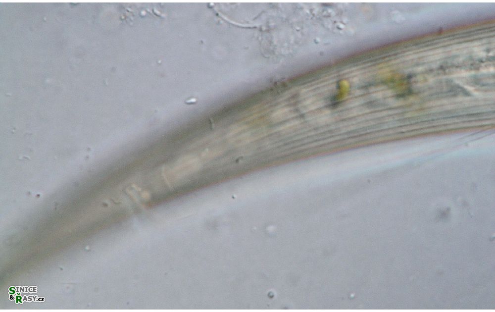 Closterium