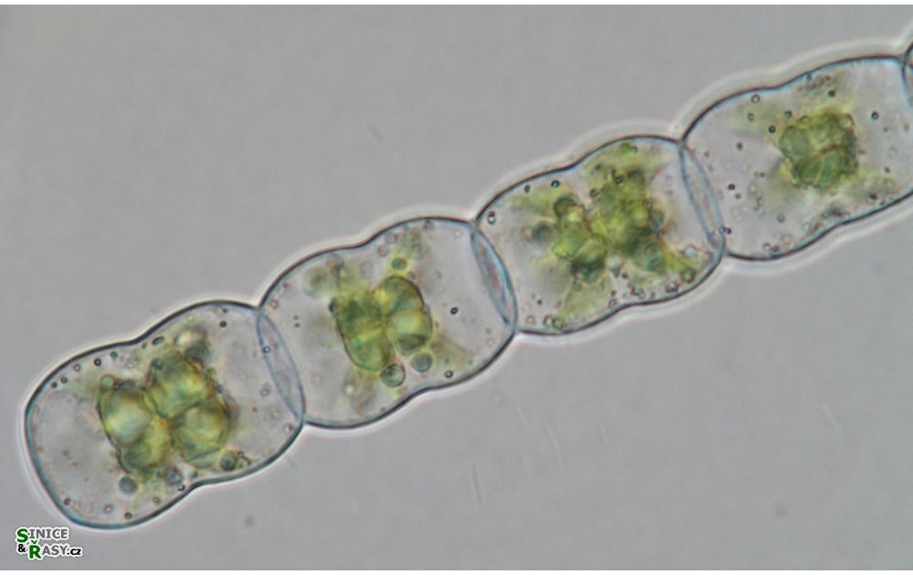 Hyalotheca