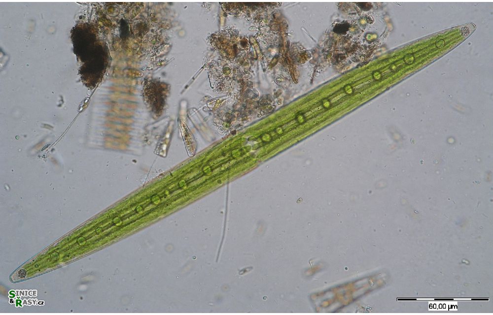 Closterium acerosum