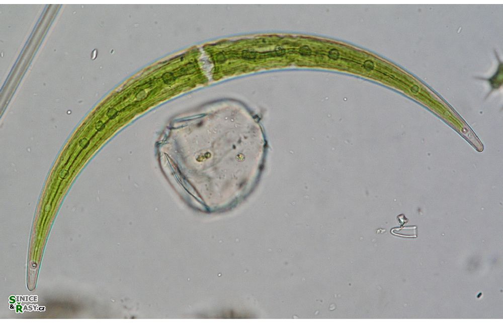 Closterium archerianum