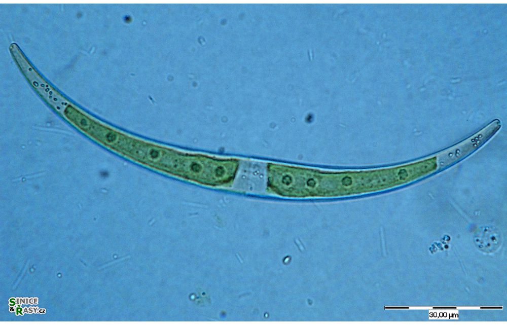 Closterium dianae