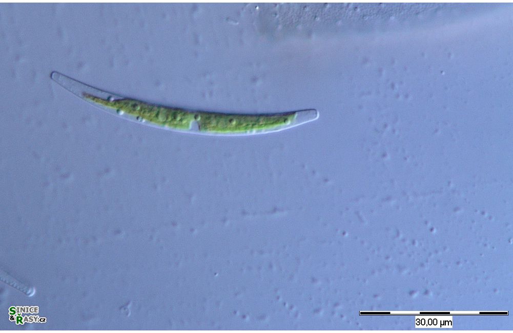 Closterium cornu