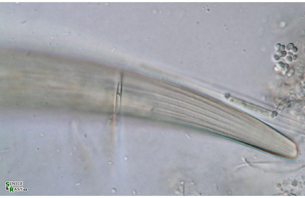 Closterium