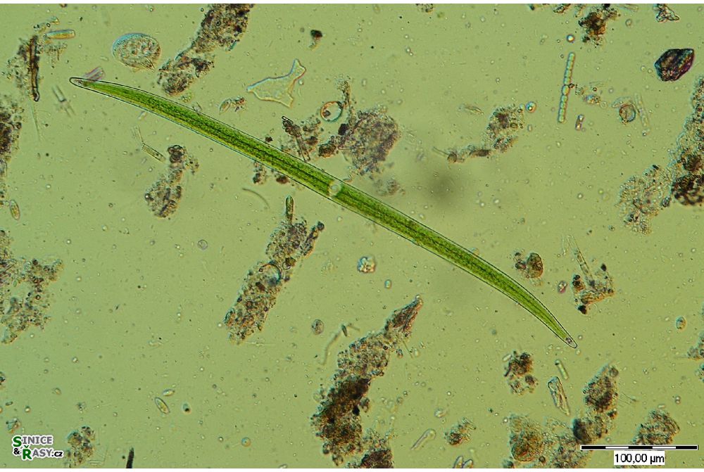Closterium praelongum