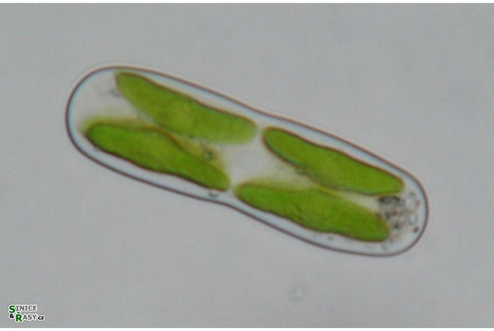 Cylindrocystis