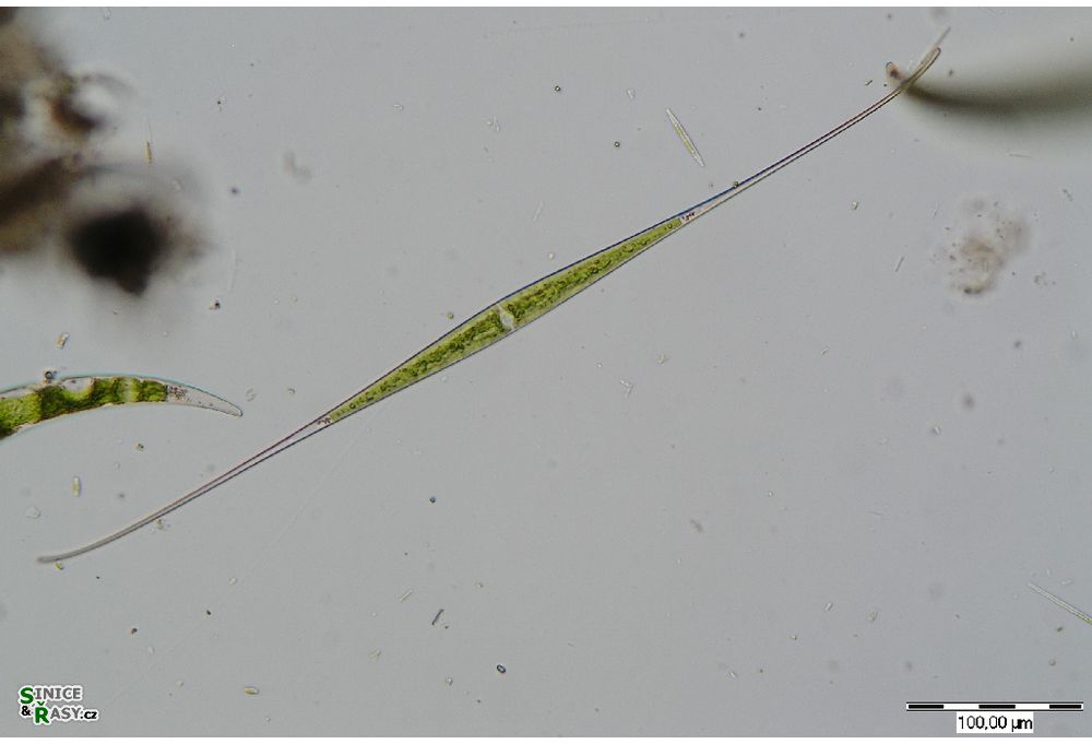 Closterium kuetzingii
