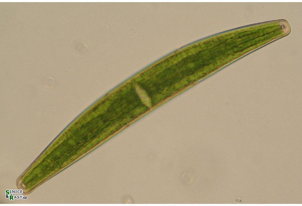 Closterium striolatum