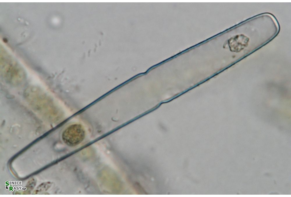 Haplotaenium minutum