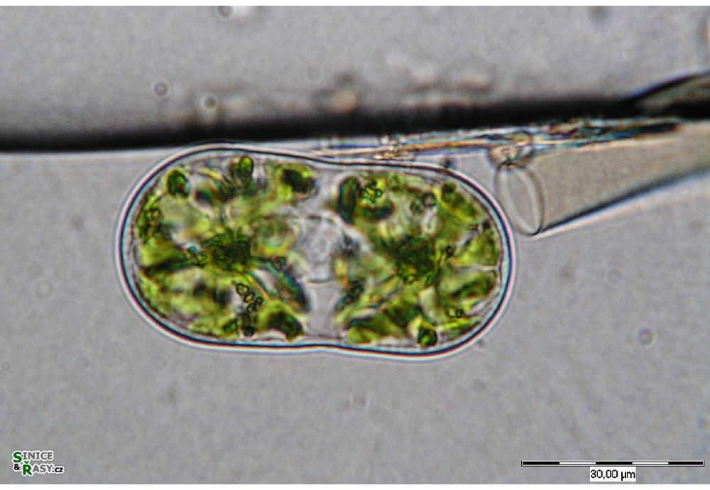 Actinotaenium diplosporum