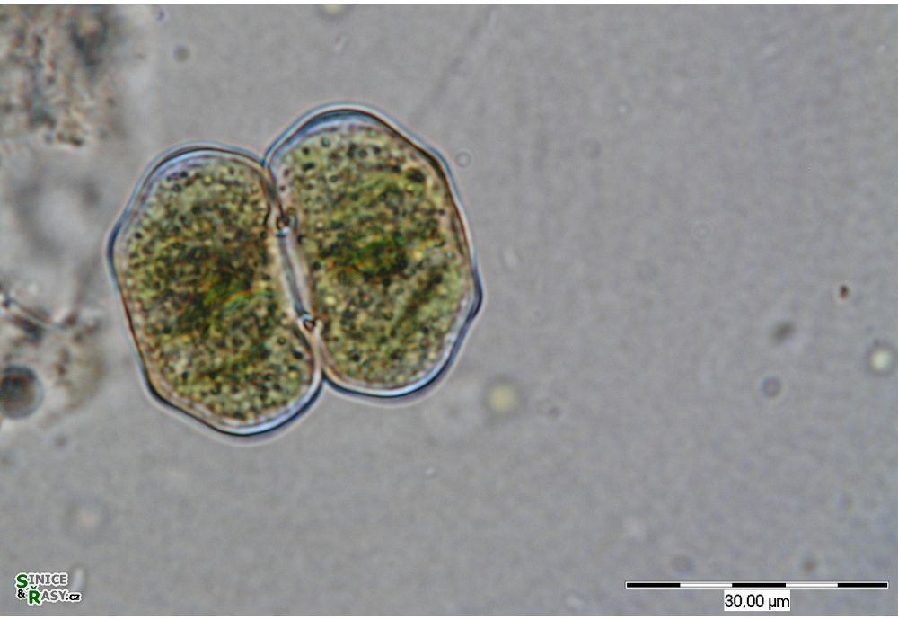 Cosmarium eichlerianum