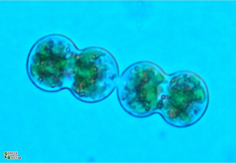 Cosmarium moniliforme