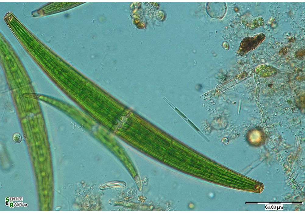 Closterium costatum