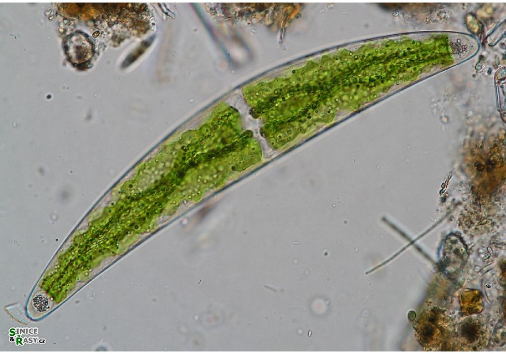 Closterium
