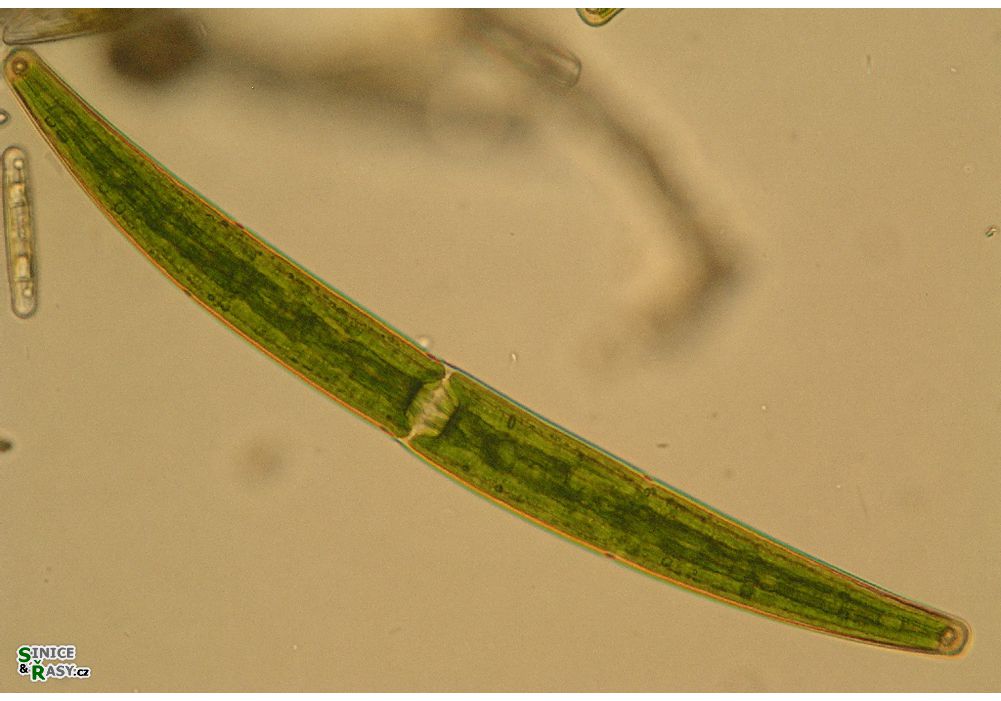 Closterium striolatum