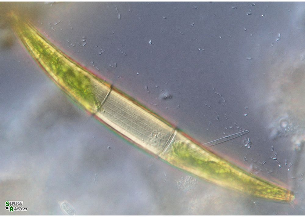 Closterium costatum