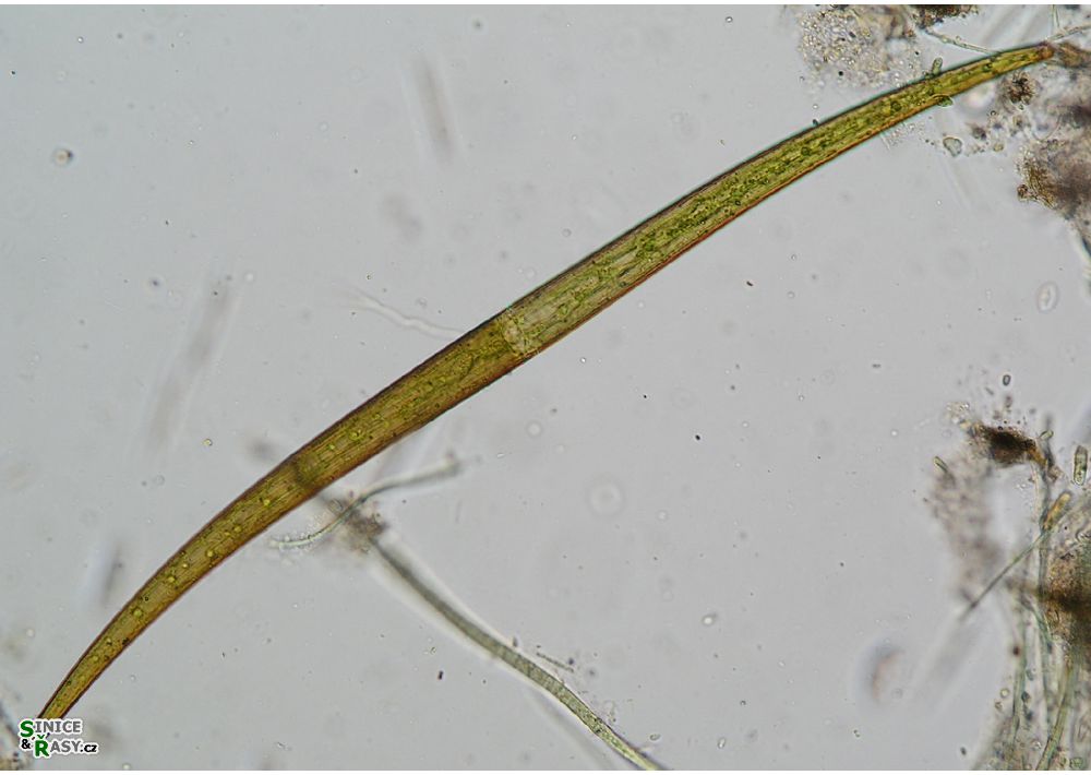 Closterium delpontei