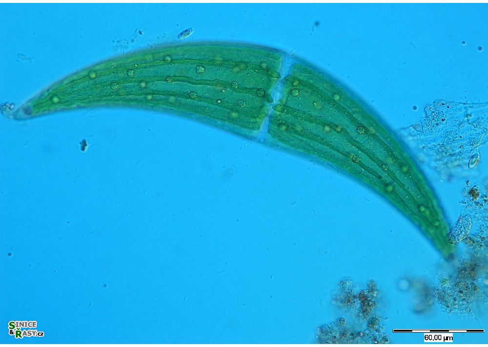Closterium ehrenbergii