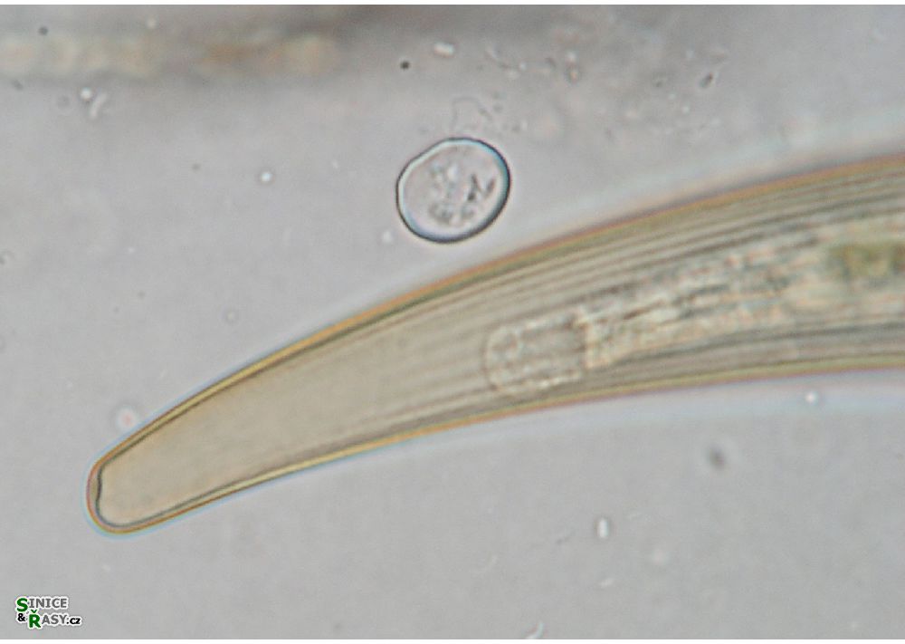 Closterium