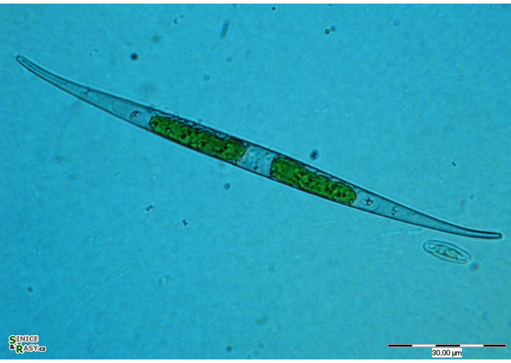 Closterium subulatum