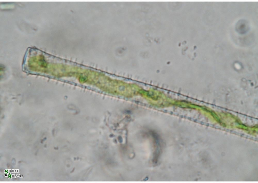 Gonatozygon aculeatum