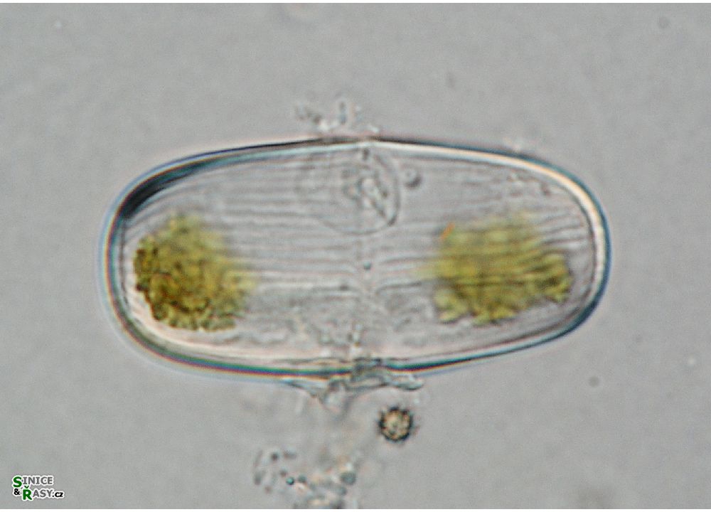 Actinotaenium silvae-nigrae