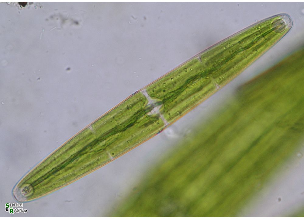 Closterium closterioides