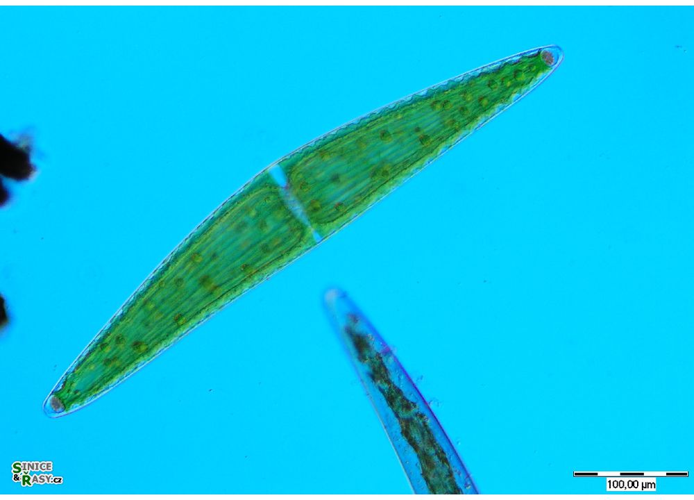 Closterium lunula