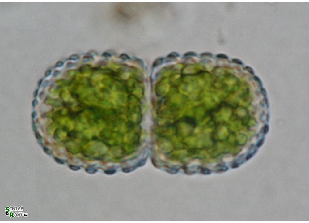 Cosmarium amoenum