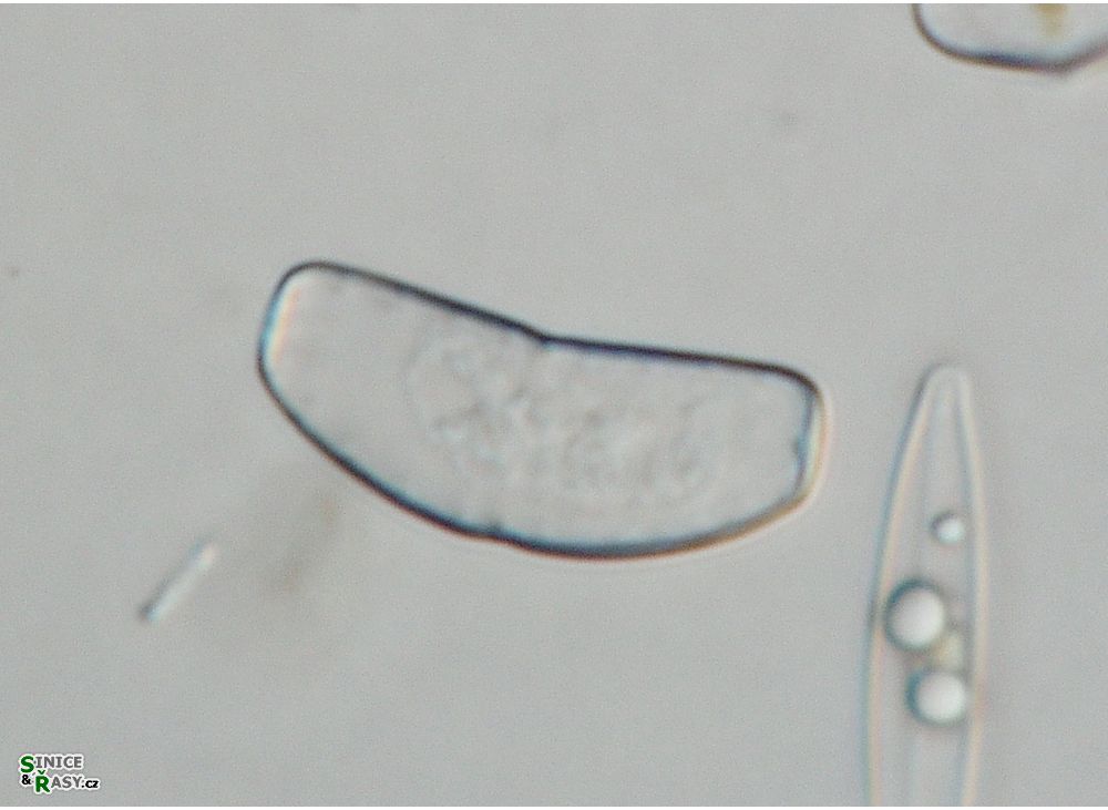 Actinotaenium infractum