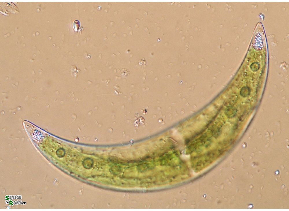 Closterium leibleinii