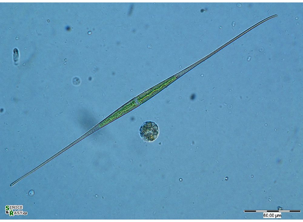Closterium setaceum