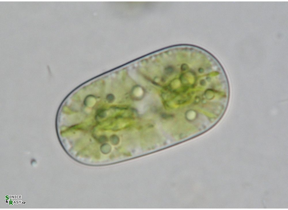 Cylindrocystis brebissonii