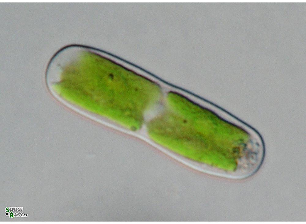 Cylindrocystis