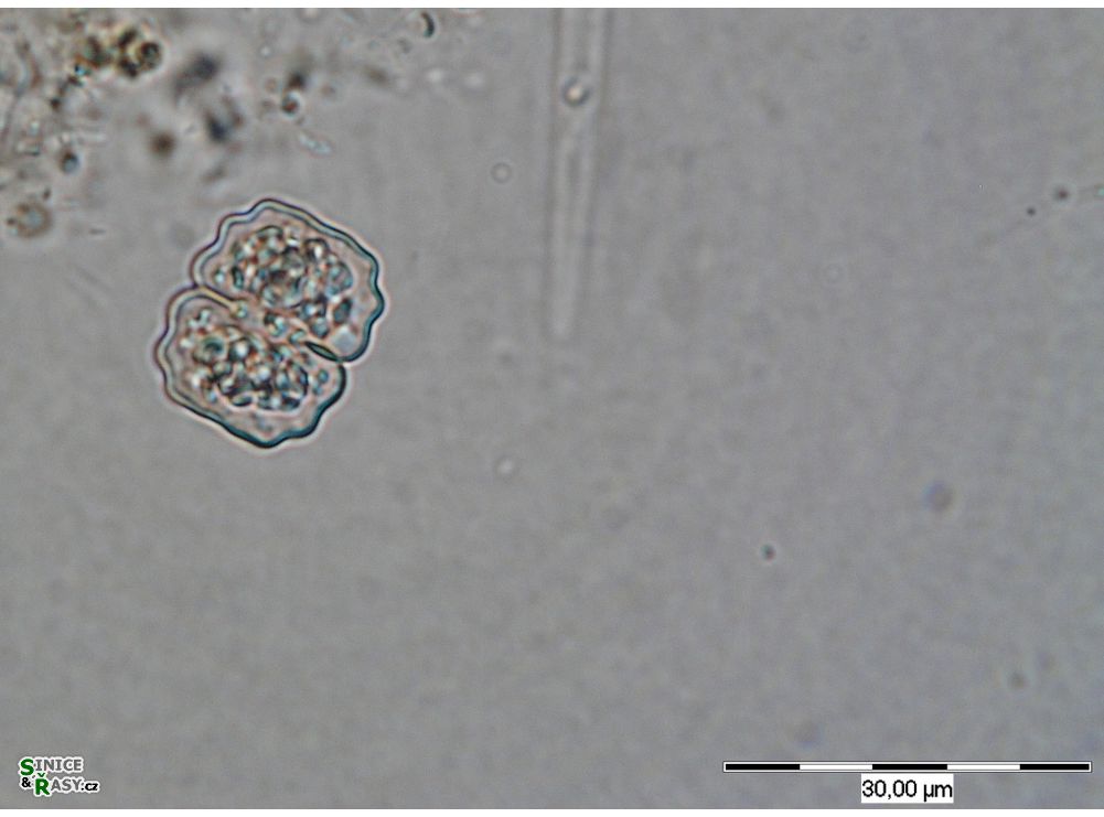 Cosmarium medioretusum