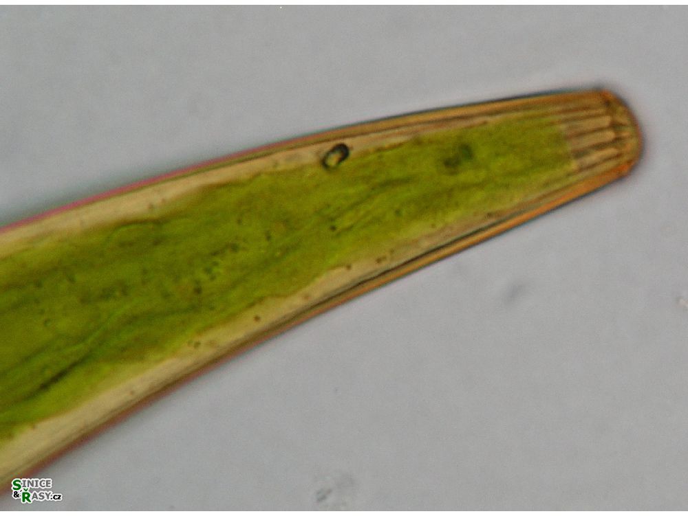 Closterium costatum