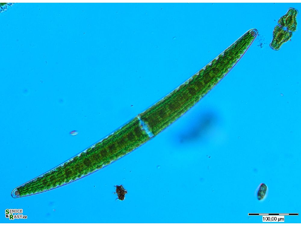 Closterium turgidum