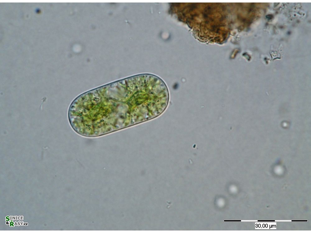 Cylindrocystis brebissonii
