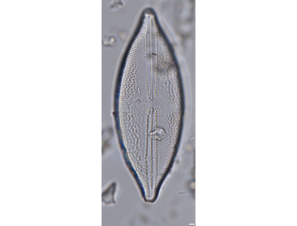 Anomoeoneis sphaerophora