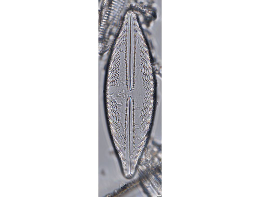 Anomoeoneis sphaerophora